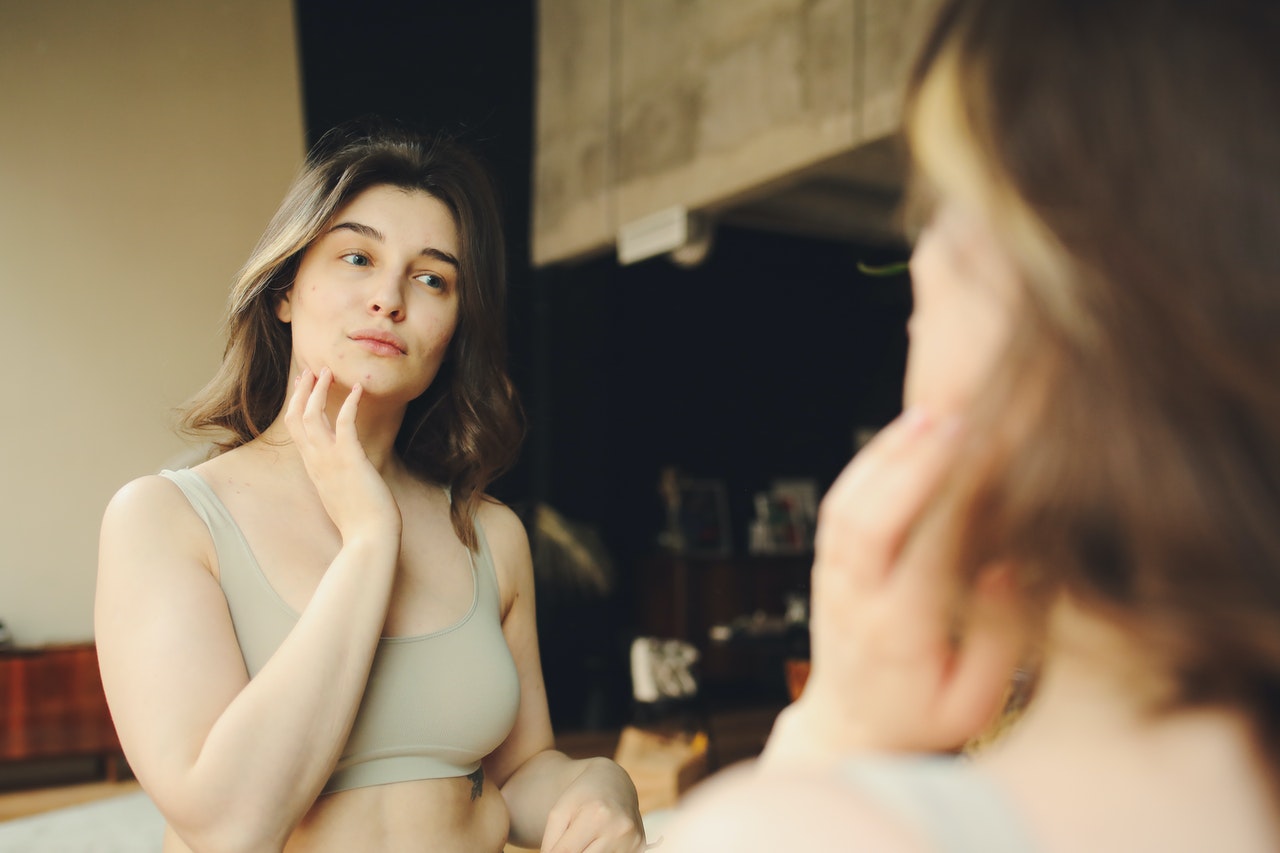 Acne giovanile: cos’è e quanto dura